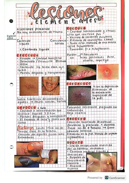 LESIONES ELEMENTALES EN DERMATOLOGÍA