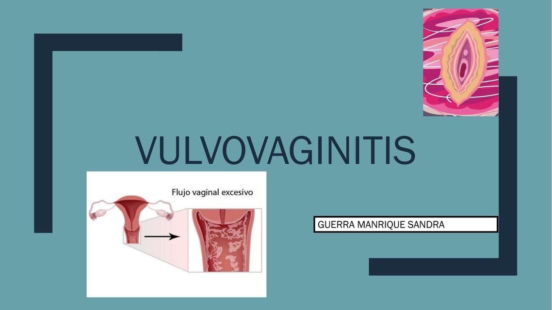 VULVOVAGINITIS