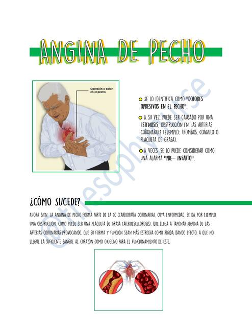 Angina de pecho - Thesophynurse