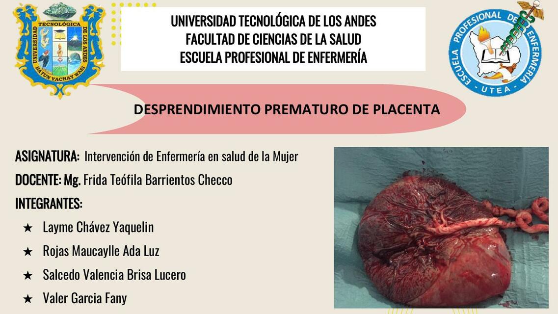 Desprendimiento Prematuro de Placenta