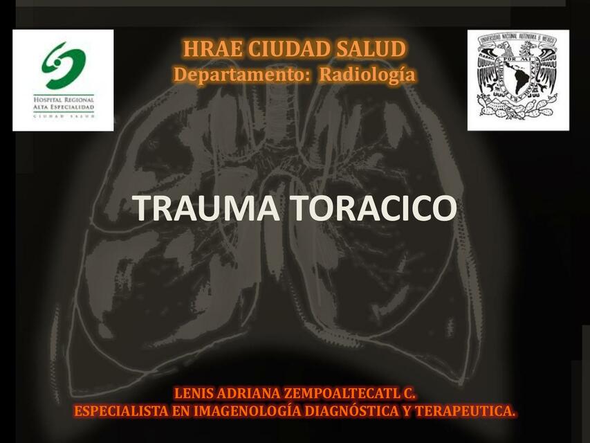 trauma de torax