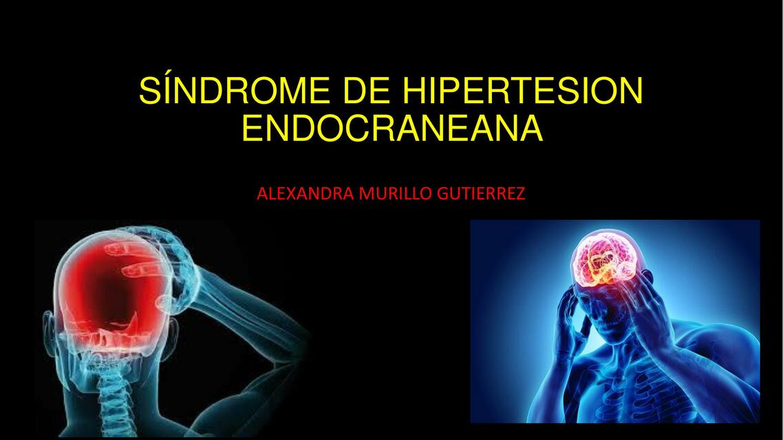 Síndrome de hipertensión Endocraneana 