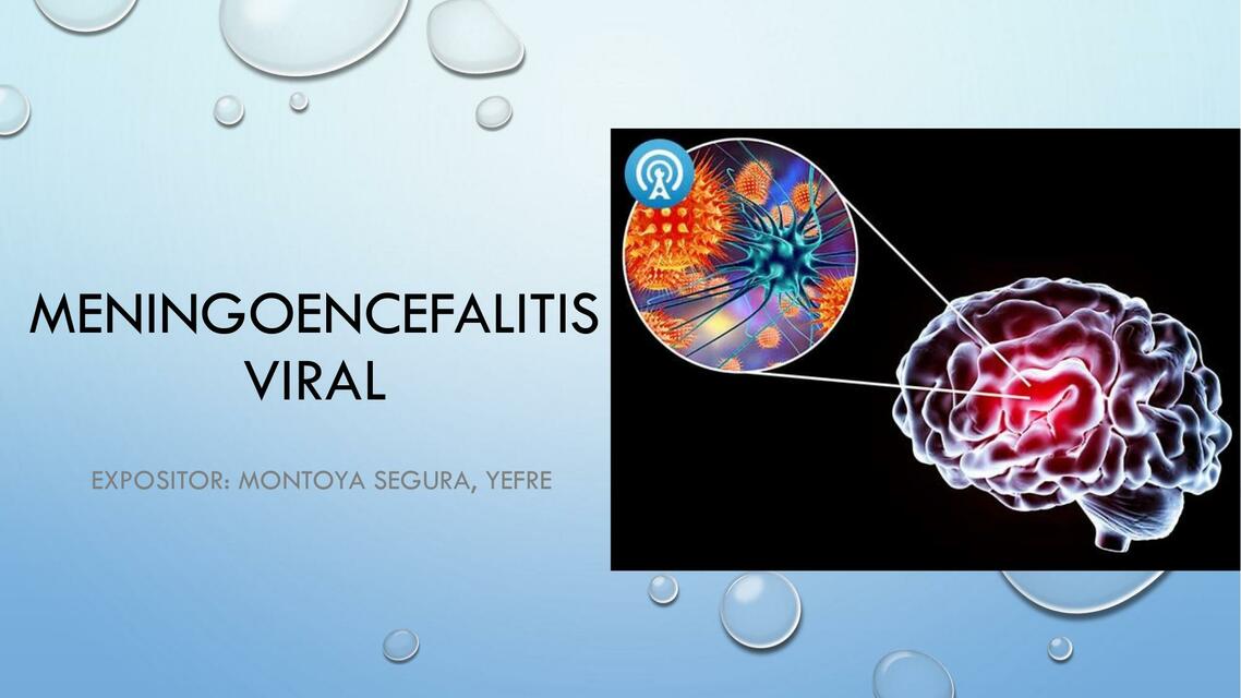 Meningoencefalitis viral