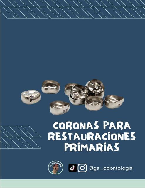 Coronas para Restauraciones Piezas Primarias