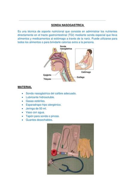sondanasogastrica