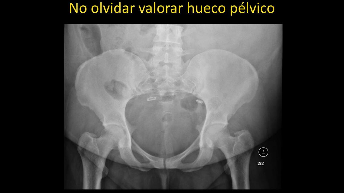 TIPS PARA VALORAR ABDOMEN