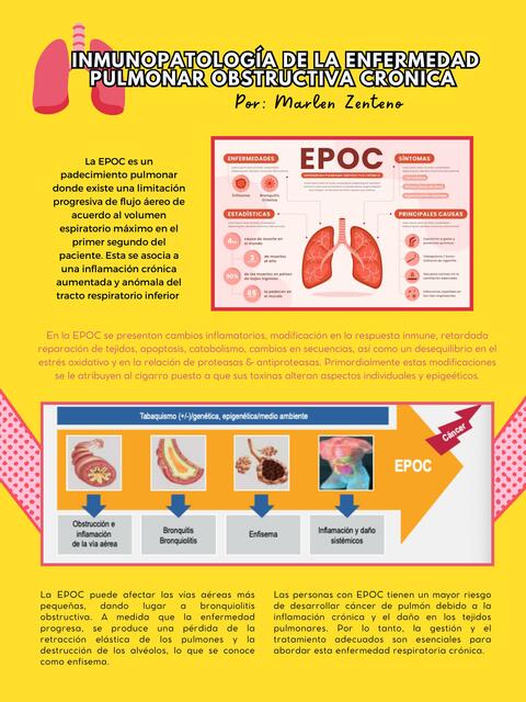 Inmunopatología de la Enfermedad Pulmonar Obstructiva Crónica 