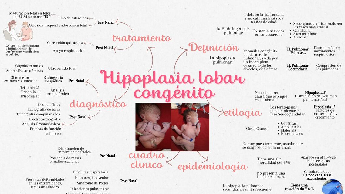 Hipoplasia lobar