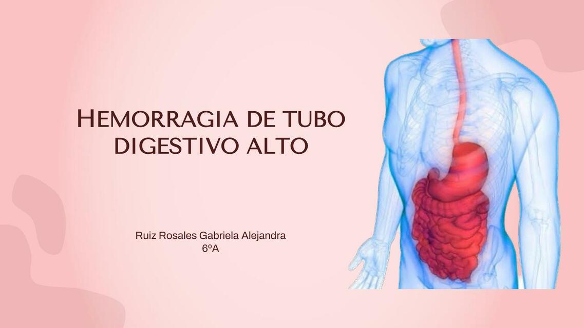 Hemorragia de tubo digestivo alto