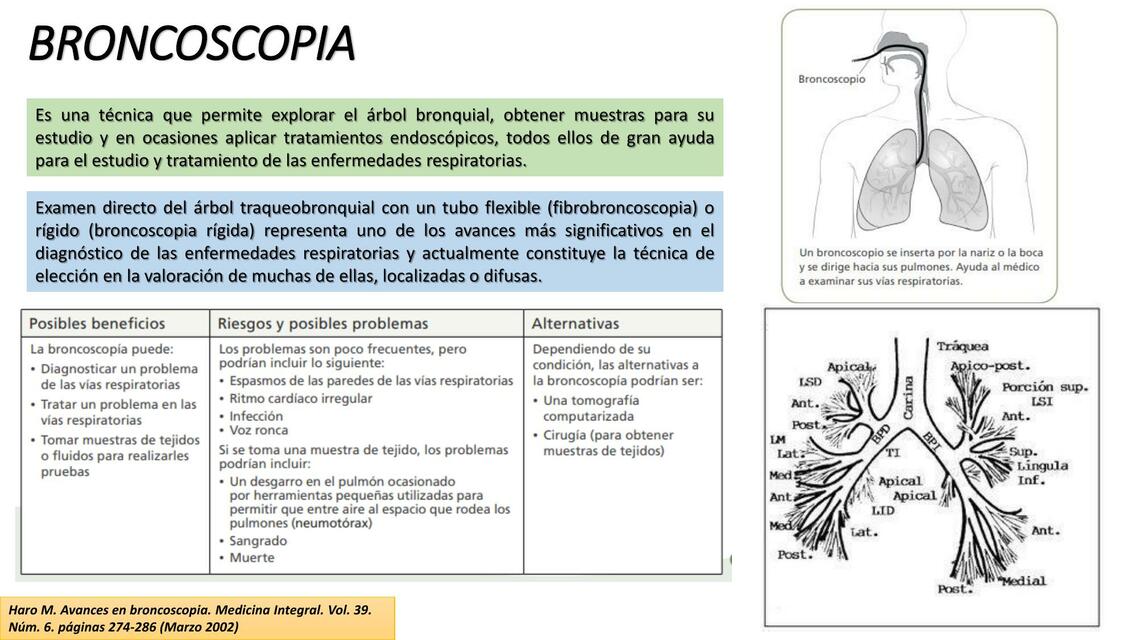 Broncoscopia