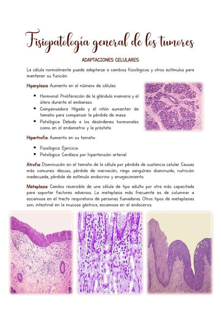 Neoplasias 