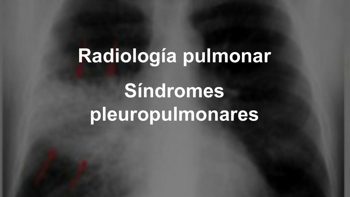 Sx pleuropulmonares y anexos