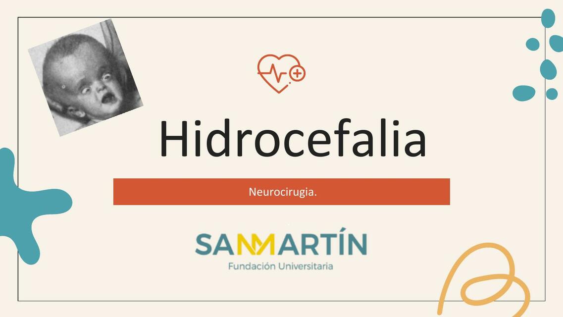 Hidrocefalia