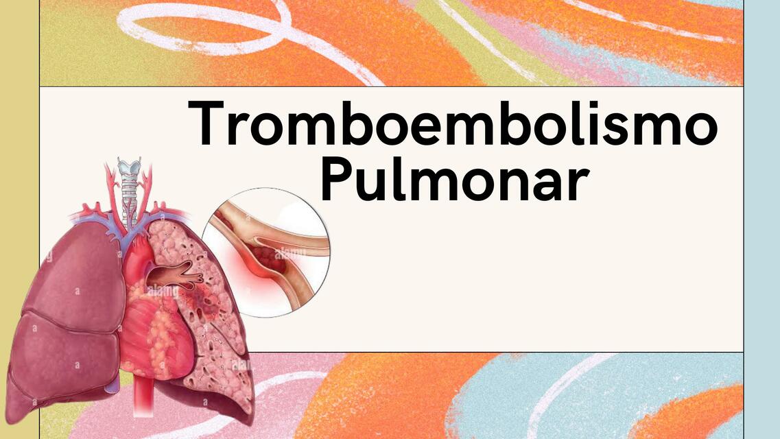 Tromboembolismo pulmonar