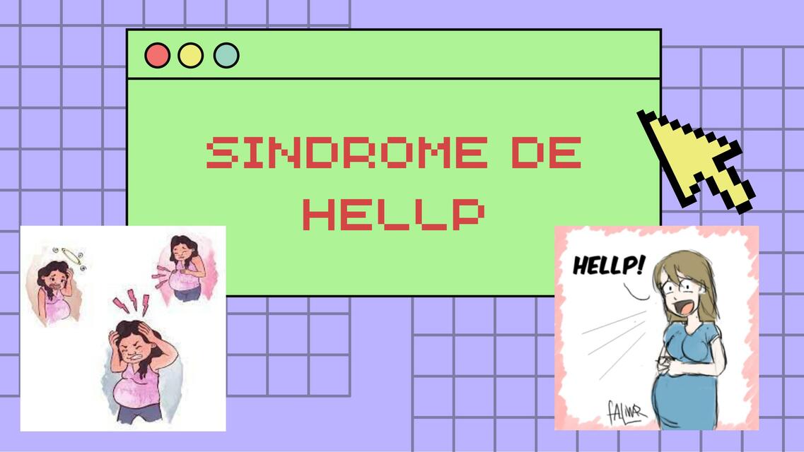 Sindrome de hellp