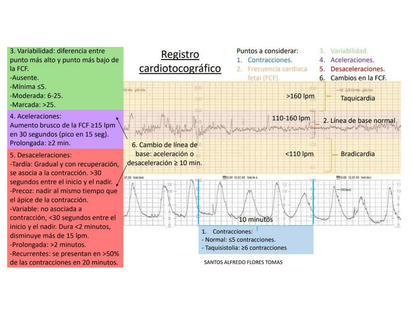 Registro Cardiotocográfico 