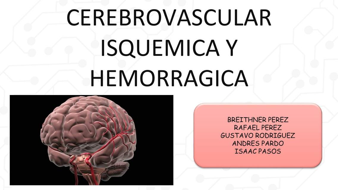 ACV isquémico y hemorrágico