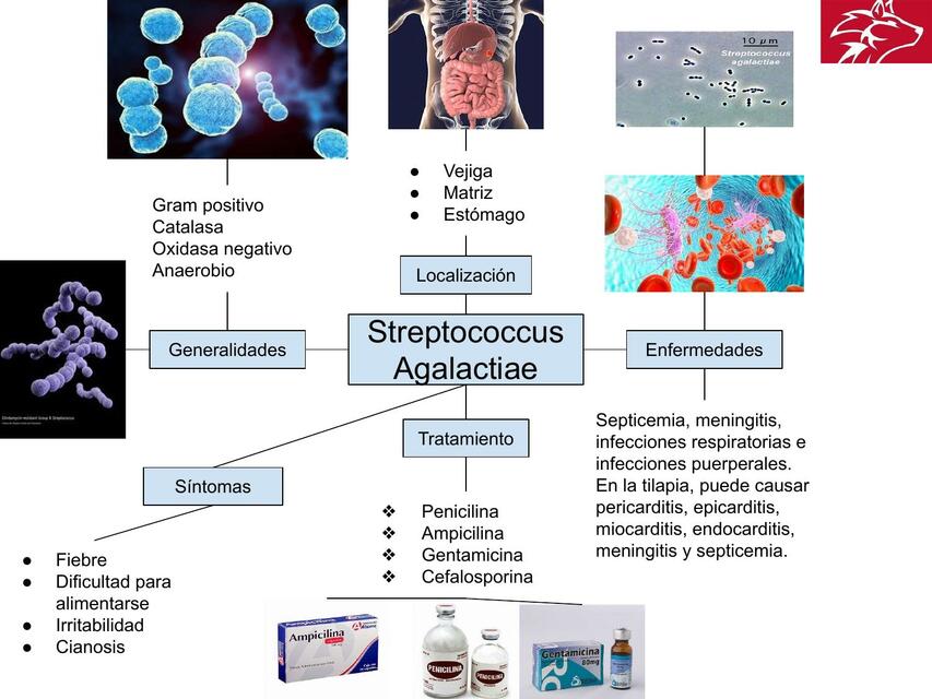 Streptococcus Agalactiae