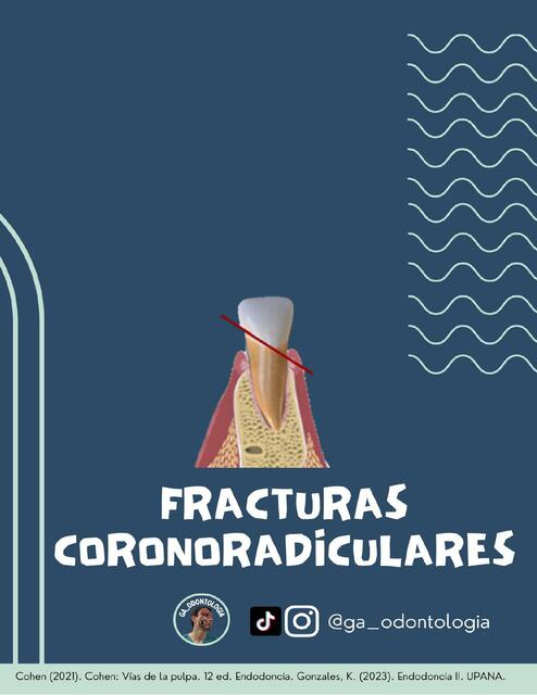 Fracturas Corono Radiculares