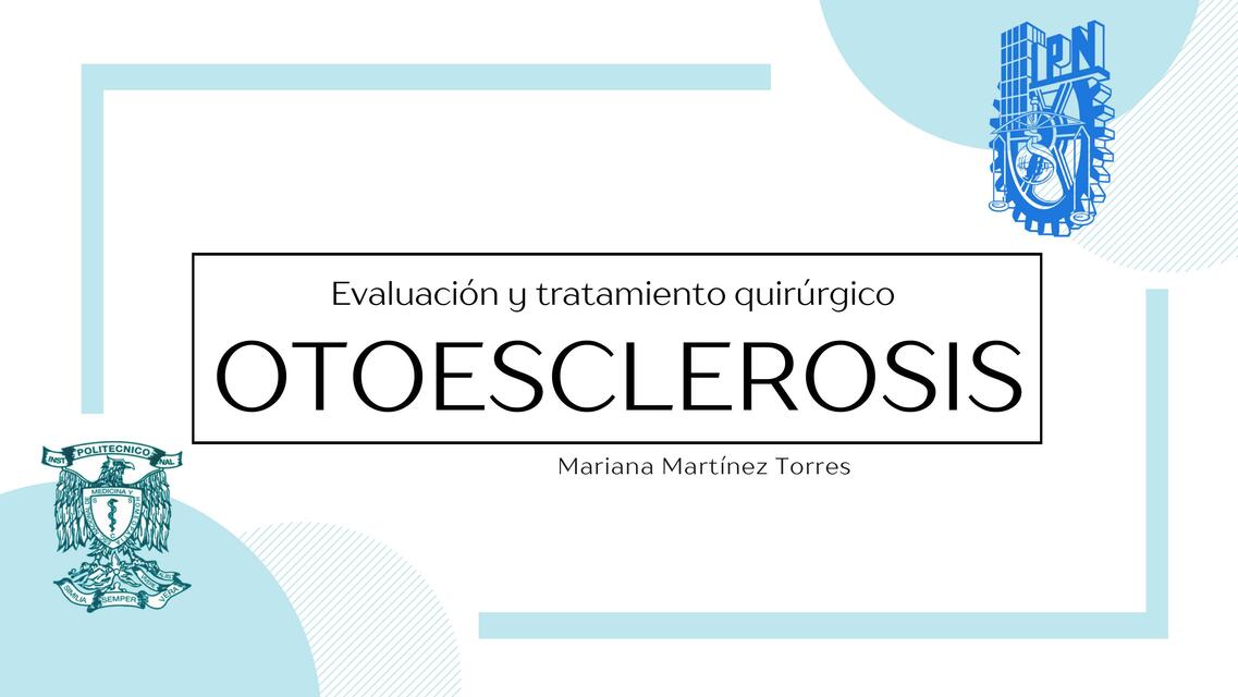 Otoesclerosis 