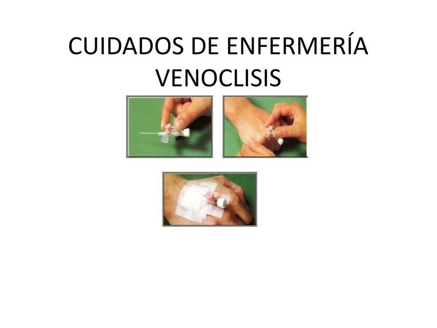 Cuidados de Enfermería- Venoclisis 