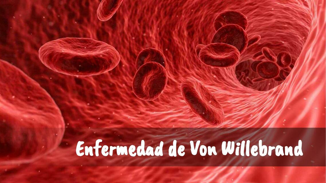 Enfermedad de Von Willebrand 