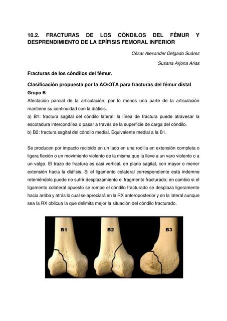 Fracturas de los Cóndilos del Fémur y Desprendimiento de la Epífisis Femoral Inferior 