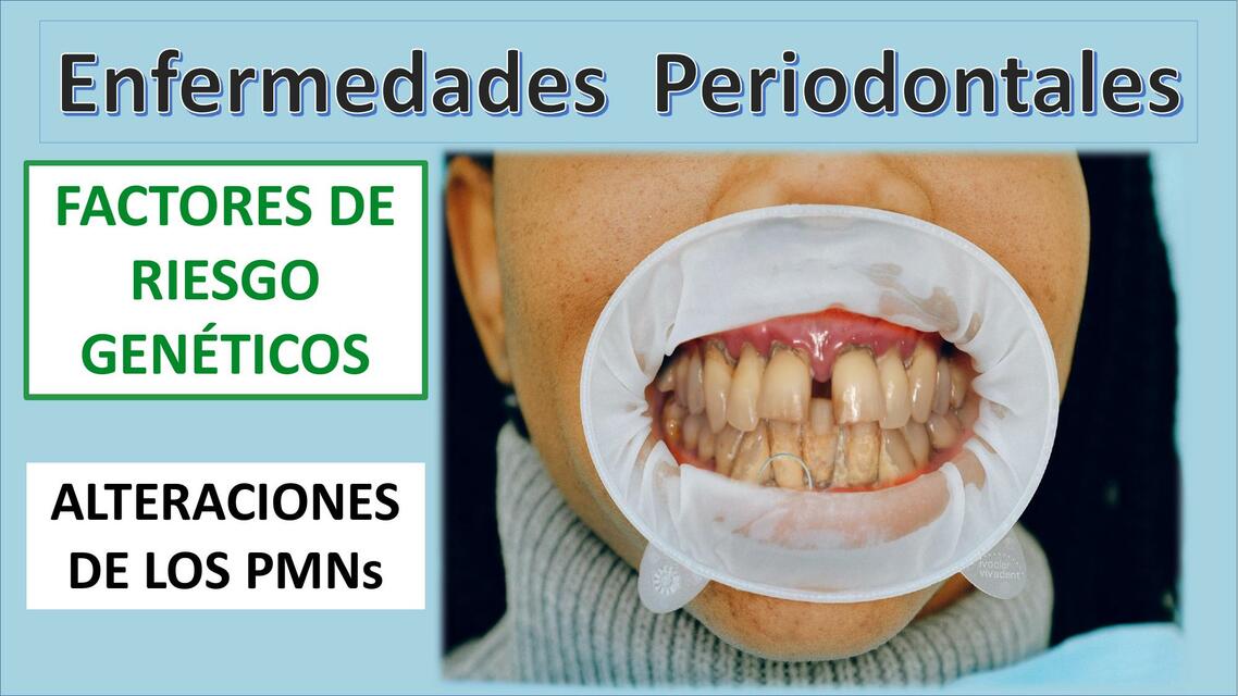 Enfermedades Periodontales: ALTERACIONES DE LOS PMN