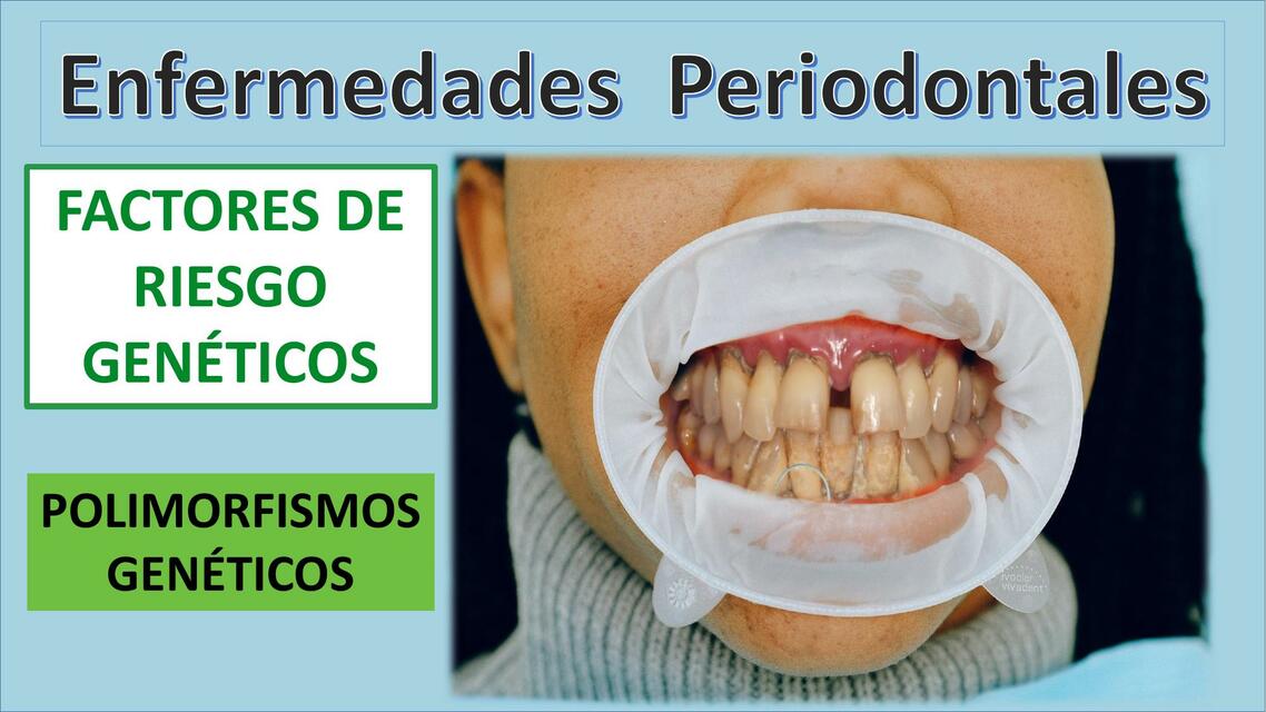 Enfermedades Periodontales: POLIMORFISMOS GENÉTICOS