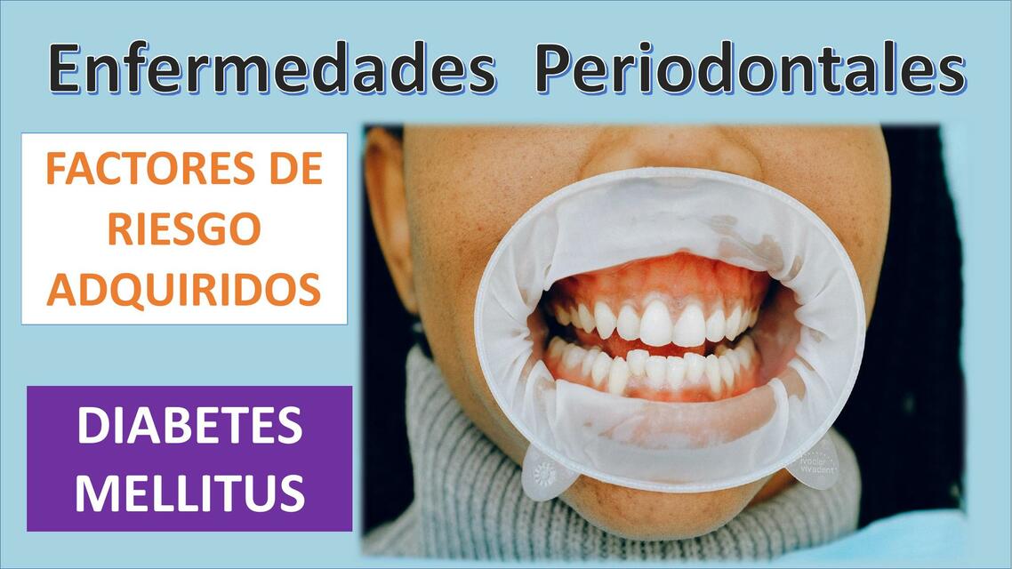 Enfermedades Periodontales: Diabetes Mellitus