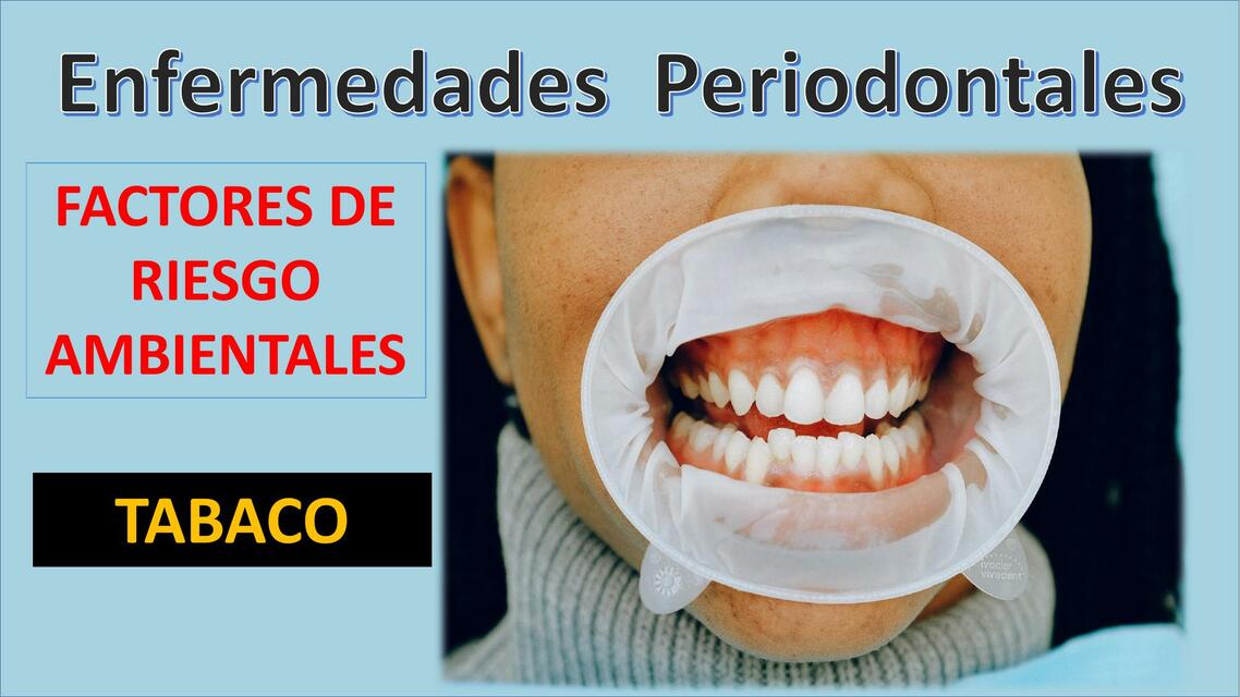 Enfermedades Periodontales: TABACO