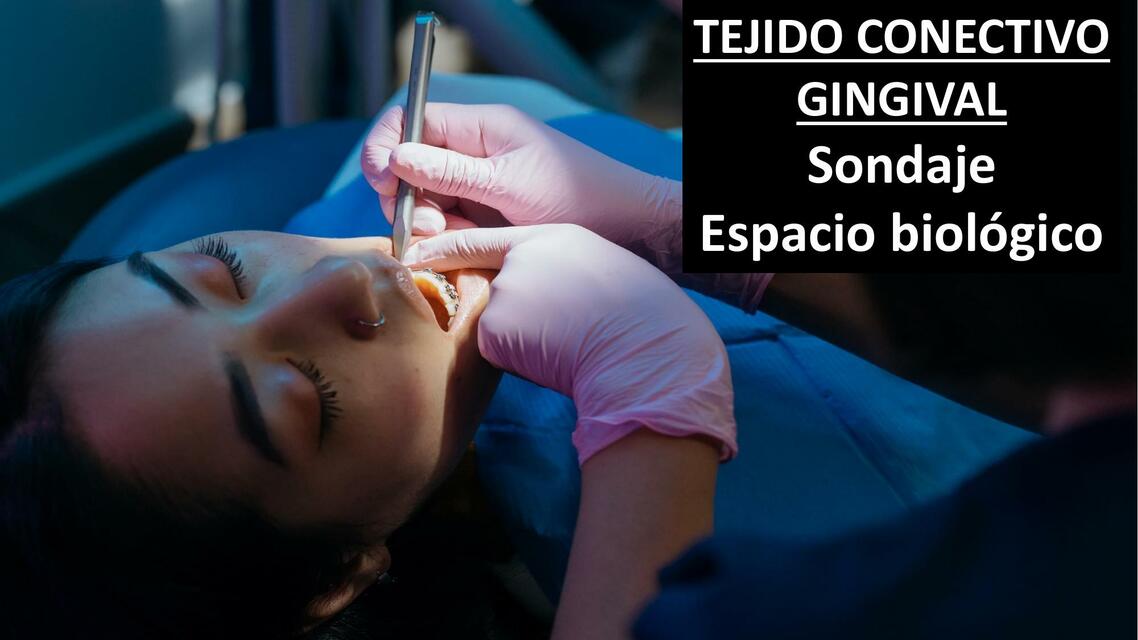 Tejido Conectivo Gingival