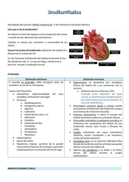 Bradiarritmias