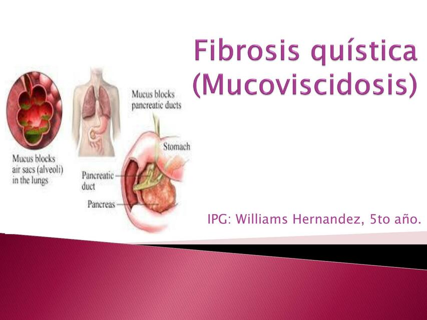 Fibrosis quística Mucoviscidosis