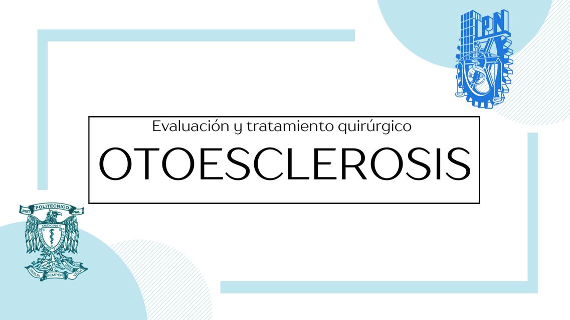 Otoesclerosis 