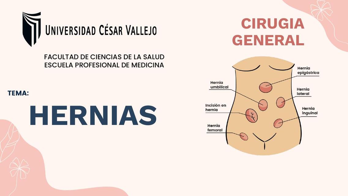 Hernias 