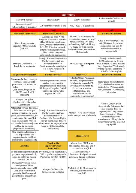 Tabla de lectura de arritmias