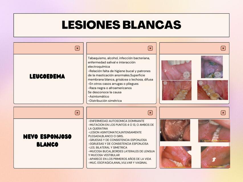 Rubie's Denti Con Apparecchio In Blister: Accessorio Scherzoso Per Feste E Travestimenti