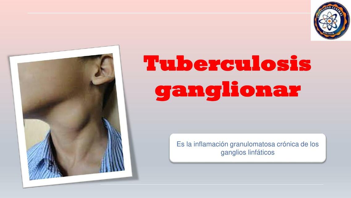 tuberculosis ganglionar y osteoarticular