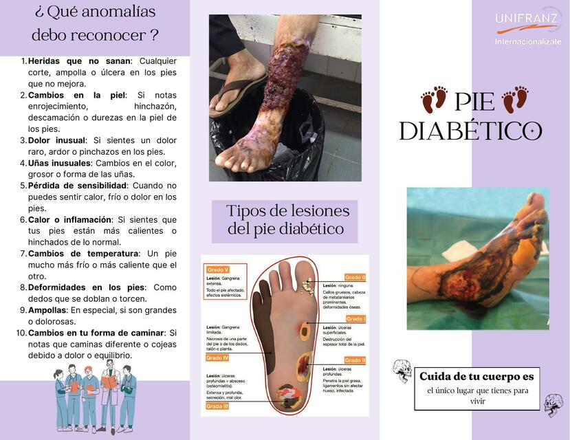 Triptico de pie diabético Lizeth G. uDocz