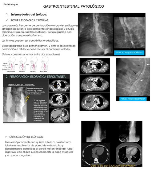 DX por Imagen Gastrointestinal 