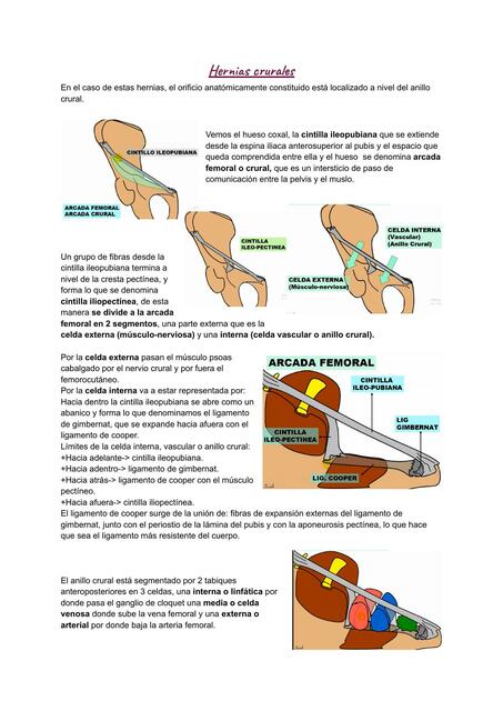 Hernias crurales