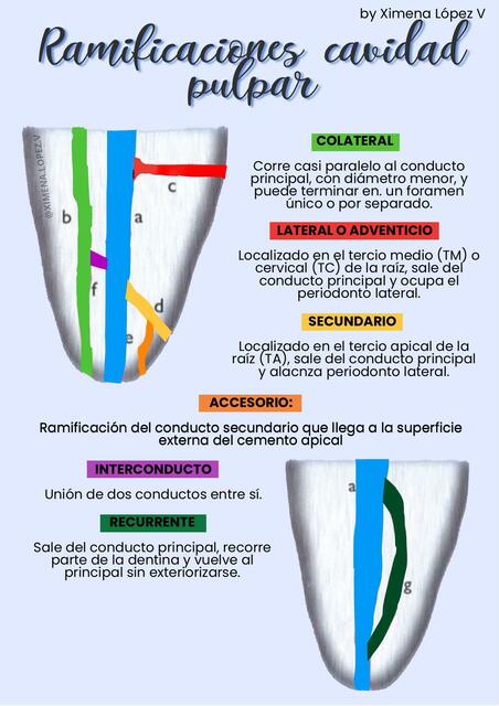 Ramificaciones cavidad pulpar