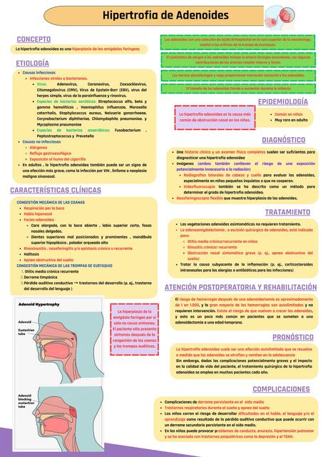 Hipertrofia de Adenoides