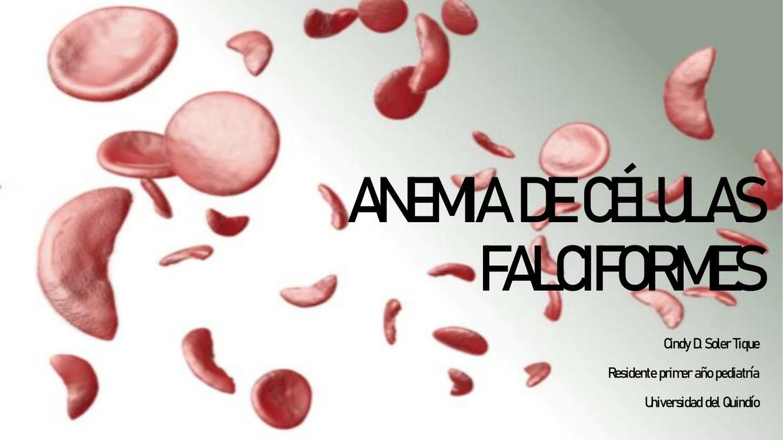 Anemia de células falciformes 