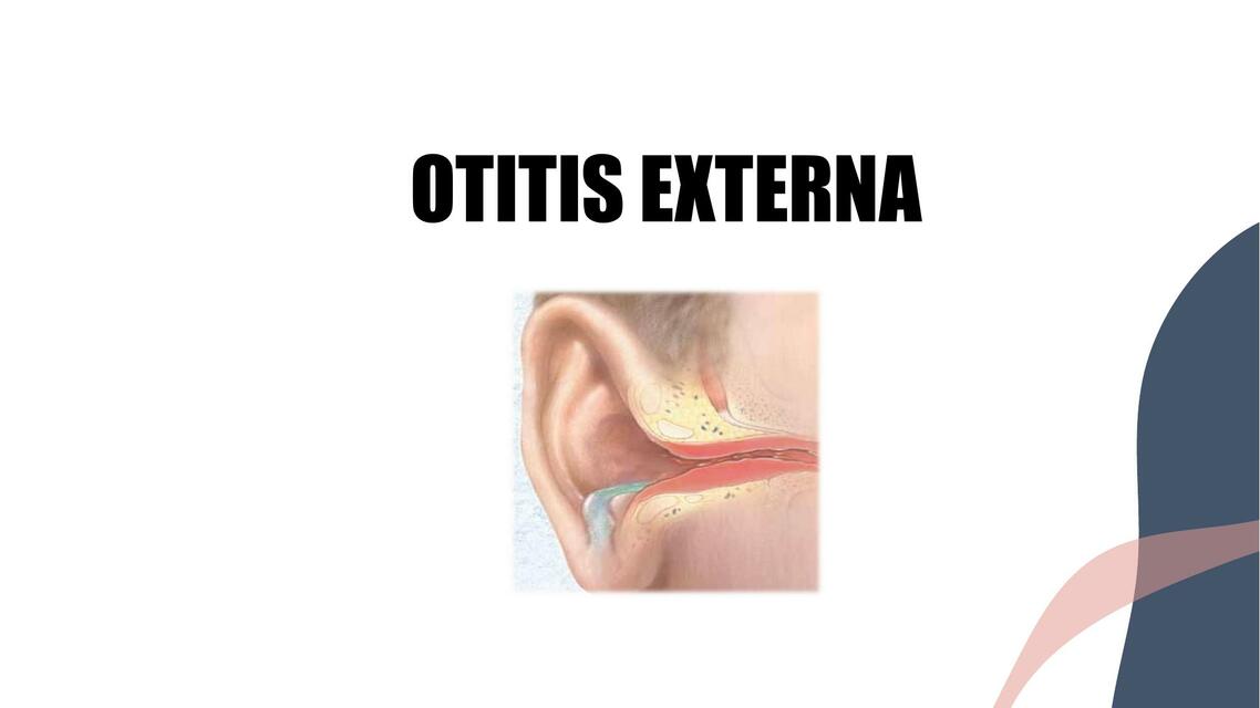 Otitis externa 