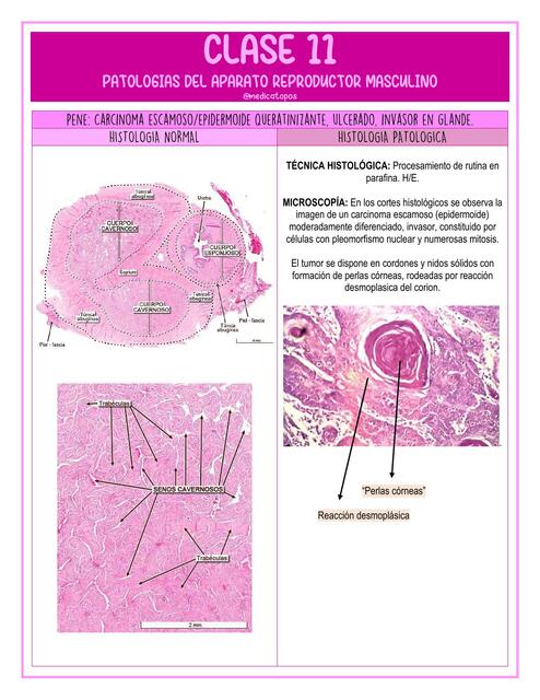 CLASE 11 Anatomía Patológica - Aparato Reproductor Masculino