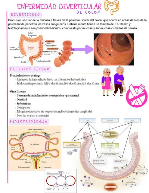 ENFERMEDAD DIVERTICULAR DE COLON