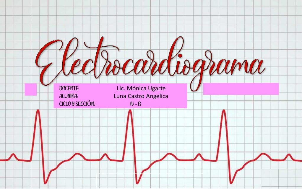 ECG ppt