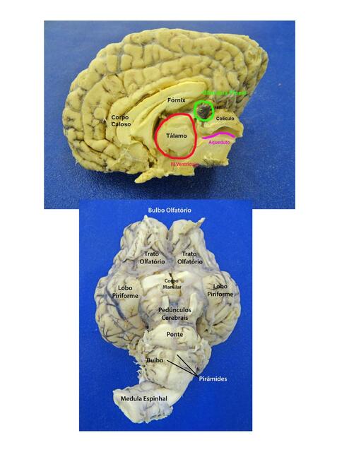 Imágenes Práctica Cerebro